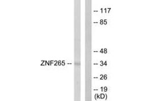 Western blot analysis of extracts from HeLa cells, using ZNF265 Antibody. (ZNF265 antibody  (AA 106-155))