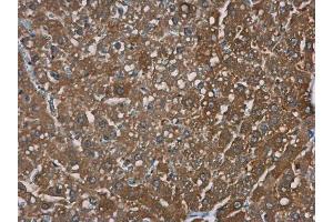 IHC-P Image TRPM2 antibody [N1N2-2], N-term detects TRPM2 protein at cytoplasm in rat liver by immunohistochemical analysis. (TRPM2 antibody  (N-Term))