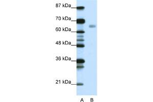 WB Suggested Anti-HSF1 Antibody Titration:  0. (HSF1 antibody  (C-Term))