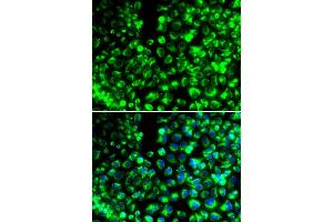 Immunofluorescence analysis of HeLa cell using CALU antibody. (CALU antibody)