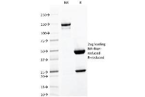 SDS-PAGE Analysis Purified CD103 Mouse Monoclonal Antibody (ITGAE/2063). (CD103 antibody)