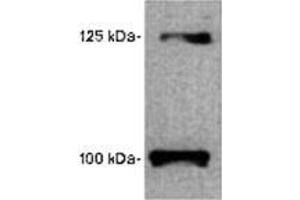 Image no. 1 for anti-Leptin Receptor (LEPR) (AA 577-594) antibody (ABIN187816) (Leptin Receptor antibody  (AA 577-594))