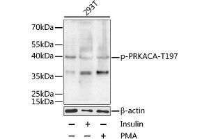 Western blot analysis of extracts of 293T cells, using Phospho-PKA C-alpha (PRKACA)-T197 antibody (ABIN6135290, ABIN6136202, ABIN6136203 and ABIN6225582) at 1:1000 dilution. (PRKACA antibody  (pThr197))
