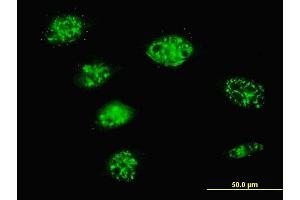 Immunofluorescence of monoclonal antibody to SMARCD3 on HeLa cell. (SMARCD3 antibody  (AA 385-483))