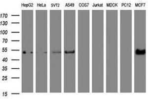 Image no. 8 for anti-Selenium Binding Protein 1 (SELENBP1) antibody (ABIN1500860) (SELENBP1 antibody)