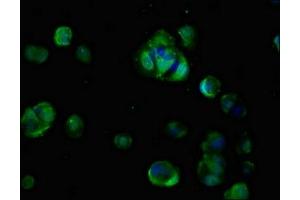 Immunofluorescent analysis of MCF-7 cells using ABIN7147251 at dilution of 1:100 and Alexa Fluor 488-congugated AffiniPure Goat Anti-Rabbit IgG(H+L) (CDON antibody  (AA 1095-1211))