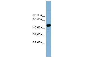 WB Suggested Anti-LANCL2 Antibody Titration: 0. (LANCL2 antibody  (Middle Region))