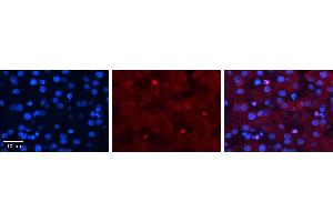 ZGPAT antibody - N-terminal region          Formalin Fixed Paraffin Embedded Tissue:  Human Liver Tissue    Observed Staining:  Nucleus in Kupffer cells of liver   Primary Antibody Concentration:  1:100    Other Working Concentrations:  1/600    Secondary Antibody:  Donkey anti-Rabbit-Cy3    Secondary Antibody Concentration:  1:200    Magnification:  20X    Exposure Time:  0. (ZGPAT antibody  (N-Term))