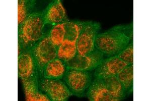 IF analysis of SAP18 using anti-SAP18 antibody (ABIN7599009) and anti-Tubulin Alpha antibody (ABIN7600339).