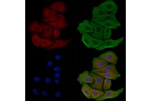 ABIN6259034 and ABIN6275060 staining Hela cells by IF/ICC.