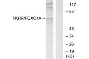Western blot analysis of extracts from HeLa cells, treated with EGF+Serum, using FKHR (Ab-256) Antibody. (FOXO1 antibody  (AA 223-272))