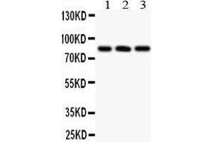 Western Blotting (WB) image for anti-Protein Phosphatase 3, Catalytic Subunit, alpha Isoform (PPP3CA) (AA 488-521), (C-Term) antibody (ABIN3042493) (PPP3CA antibody  (C-Term))