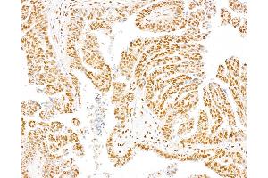 Immunohistochemistry (IHC) image for anti-Dpy-30 Homolog (DPY30) (AA 1-50) antibody (ABIN7453464) (DPY30 antibody  (AA 1-50))