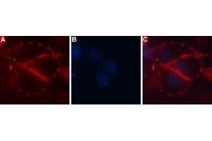 Expression of CaVα2δ4 in rat C6 cells - Cell surface detection of CaVα2δ4 in intact living rat brain glioma (C6) cells.