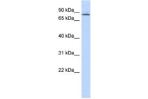 WB Suggested Anti-APBB2 Antibody Titration: 0. (APBB2 antibody  (Middle Region))