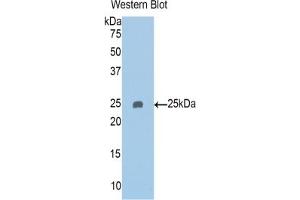 Detection of Recombinant PAPPA2, Human using Polyclonal Antibody to Pappalysin 2 (PAPPA2) (PAPPA2 antibody  (AA 888-1093))