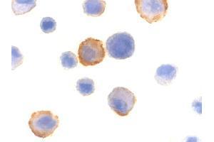 Immunocytochemistry of BMF in HeLa cells with BMF polyclonal antibody  at 10 ug/mL . (BMF antibody  (N-Term))
