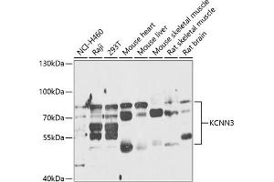 Western blot analysis of extracts of various cell lines, using KCNN3 antibody (ABIN6131839, ABIN6142768, ABIN6142770 and ABIN6218217) at 1:1000 dilution. (KCNN3 antibody  (AA 237-426))