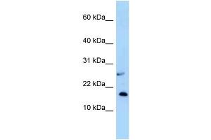 WB Suggested Anti-Nudt15 Antibody Titration: 1. (NUDT15 antibody  (N-Term))