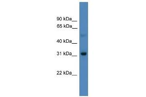 WB Suggested Anti-LBX1 Antibody Titration:  0. (Lbx1 antibody  (N-Term))