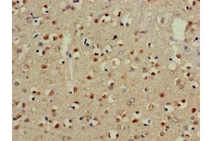 Immunohistochemistry of paraffin-embedded human brain tissue using ABIN7147247 at dilution of 1:100