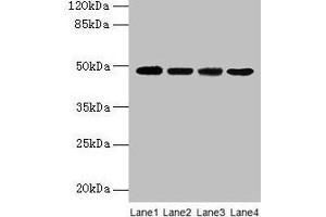 Western blot All lanes: INHBA antibody at 2 μg/mL Lane 1: Hela whole cell lysate Lane 2: HepG2 whole cell lysate Lane 3: A549 whole cell lysate Lane 4: MCF-7 whole cell lysate Secondary Goat polyclonal to rabbit IgG at 1/10000 dilution Predicted band size: 48 kDa Observed band size: 48 kDa (INHBA antibody  (AA 311-426))