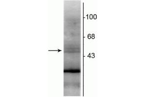 Western blot of rat hippocampal lysate showing specific immunolabeling of the ~48 kDa RXR-β protein. (Retinoid X Receptor beta antibody)