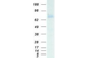 Validation with Western Blot