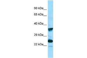 WB Suggested Anti-MRGPRX4 Antibody Titration: 1. (MRGPRX4 antibody  (C-Term))