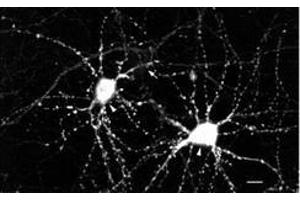 Image no. 2 for anti-Calcium/calmodulin-Dependent Protein Kinase II beta (CAMK2B) (pThr286), (Thr287) antibody (ABIN466897) (CAMK2B antibody  (pThr286, Thr287))