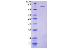SDS-PAGE (SDS) image for Taxilin alpha (TXLNA) (AA 1-234) protein (His tag,GST tag) (ABIN2123641)