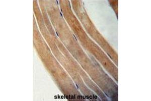 EFTUD1 antibody (C-term) immunohistochemistry analysis in formalin fixed and paraffin embedded human skeletal muscle followed by peroxidase conjugation of the secondary antibody and DAB staining.