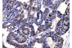 IHC analysis of p57 Kip2/CDKN1C using anti-p57 Kip2/CDKN1C antibody (ABIN7603232). (CDKN1C antibody  (N-Term))