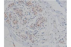 ABIN6267359 at 1/200 staining Human heart tissue sections by IHC-P. (MAPT antibody  (pThr231))