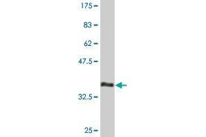 Western Blot detection against Immunogen (33. (COL23A1 antibody  (AA 338-410))