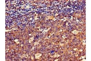 Immunohistochemistry of paraffin-embedded human tonsil tissue using ABIN7148581 at dilution of 1:100 (SPRR1A antibody  (AA 8-72))
