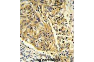 Immunohistochemistry (IHC) image for anti-Clathrin, Light Chain A (CLTA) antibody (ABIN3004002) (CLTA antibody)