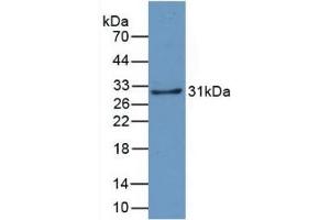 Detection of Recombinant CRYl1, Human using Monoclonal Antibody to Crystallin Lambda 1 (CRYl1) (CRYL1 antibody  (AA 24-232))