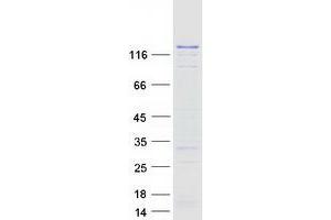 Validation with Western Blot (DNMT3A Protein (Transcript Variant 3) (Myc-DYKDDDDK Tag))