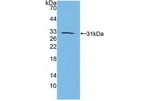 Detection of Recombinant RARb, Human using Polyclonal Antibody to Retinoic Acid Receptor Beta (RARb) (Retinoic Acid Receptor beta antibody  (AA 205-451))