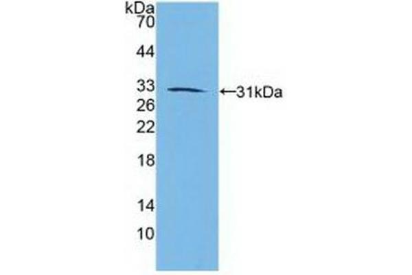 Retinoic Acid Receptor beta anticorps  (AA 205-451)