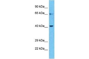 Host:  Rabbit  Target Name:  BTBD6  Sample Type:  Stomach Tumor lysates  Antibody Dilution:  1. (BTBD6 antibody  (C-Term))