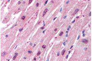 Human Heart (formalin-fixed, paraffin-embedded) stained with HUWE1 antibody ABIN213933 at 5 ug/ml followed by biotinylated goat anti-rabbit IgG secondary antibody ABIN481713, alkaline phosphatase-streptavidin and chromogen. (HUWE1 antibody  (C-Term))