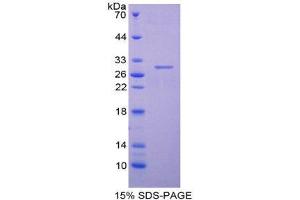 SDS-PAGE (SDS) image for Centromere Protein H (CENPH) (AA 28-241) protein (His tag) (ABIN2124299)