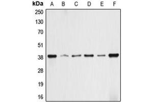 Western blot analysis of ALDOA expression in HEK293T (A), HepG2 (B), HeLa (C), NIH3T3 (D), PC12 (E), rat skeletal muscle (F) whole cell lysates.