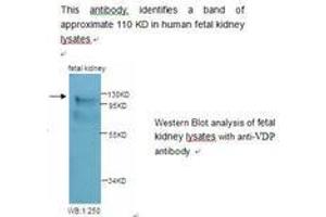 Image no. 1 for anti-USO1 Homolog, Vesicle Docking Protein (USO1) antibody (ABIN790813) (USO1 antibody)