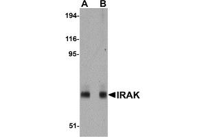 Western Blotting (WB) image for anti-Interleukin-1 Receptor-Associated Kinase 1 (IRAK1) (AA 618-712) antibody (ABIN492548) (IRAK1 antibody  (AA 618-712))