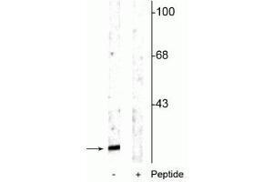Western blot of rat cortical lysate showing specific immunolabeling of the ~15 kDa alpha synuclein protein phosphorylated at Ser129 in the first lane (-). (SNCA antibody  (pSer129))