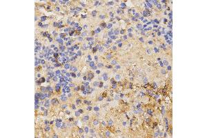 Immunohistochemistry of paraffin-embedded mouse liver fibrosis tissue using CSF2RA antibody at dilution of 1:200 (x400 lens) (CSF2RA antibody)