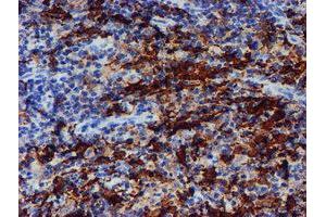 Image no. 4 for anti-Arachidonate 15-Lipoxygenase (ALOX15) antibody (ABIN1496358) (ALOX15 antibody)